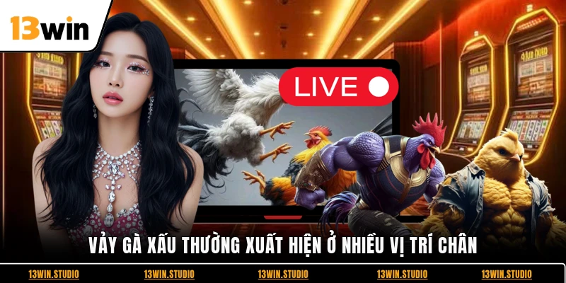 Vảy gà xấu thường xuất hiện ở nhiều vị trí chân